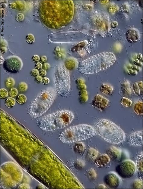 All Sorts Of Little Things In The Water Microscopic Photography