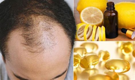Hair Loss Treatments What Are The Best Natural Remedies To Boost Hair