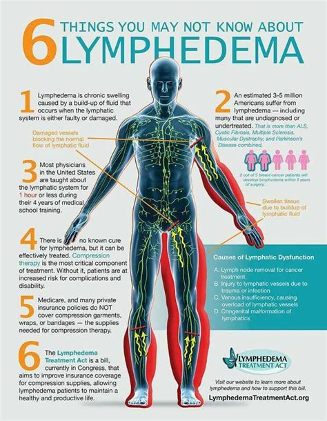 Pin By Mingy On Lymphedema Lymphedema Treatment Lymphedema