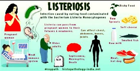 Listeriosis Symptoms Food And Prevention