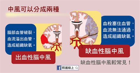 This is required to prevent automated submissions. 中風