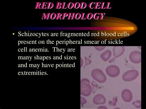 Ppt Red Blood Cell Morphology Powerpoint Presentation Free Download