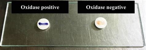 Oxidase Test Showing Oxidase Positive Left Side And Oxidase Negative