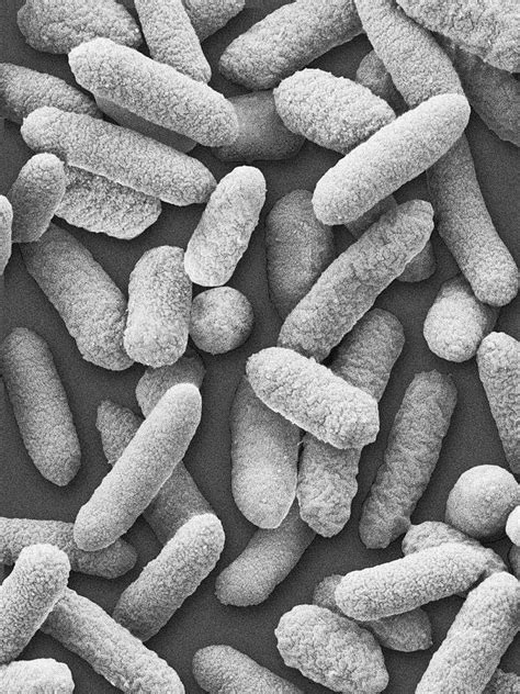 Cronobacter Sakazakii Photograph By Dennis Kunkel Microscopyscience