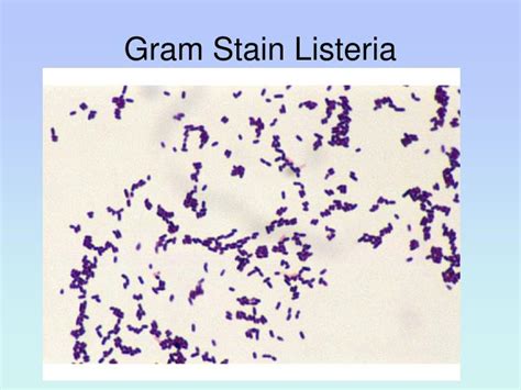 However, with older cultures the gram stain reaction can be variable and also cells may appear spheroidal. PPT - Listeria PowerPoint Presentation - ID:4585422