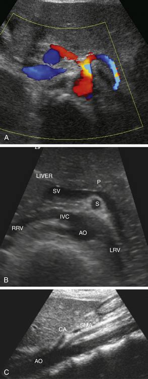 Ultrasound Assessment Of The Splanchnic Mesenteric Arteries