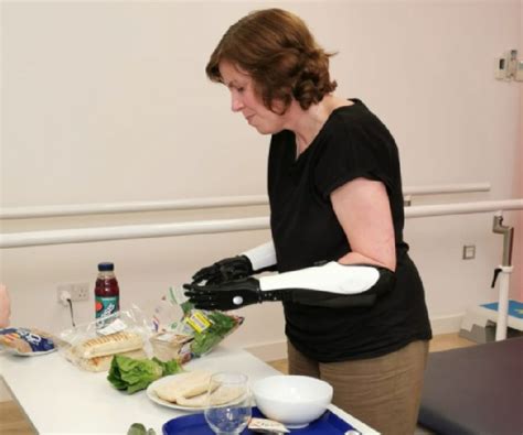 Hero Arm For Double Arm Amputees Open Bionics