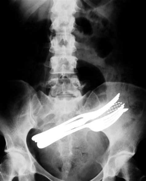 These X Rays Are Shocking And Fascinating X Ray Weird Pictures