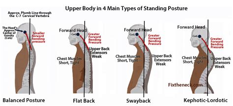 Poor Posture Treatment Snyder Chiropractic And Wellness