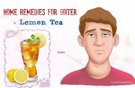 25 Home Remedies For Goiter Pain And Swelling Relief