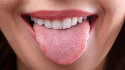 Causes Of Inflamed Swollen Taste Buds According To Doctors Ph