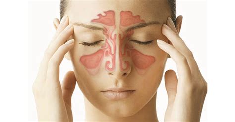 Nasal Congestion Causes Treatment Home Remedies And M