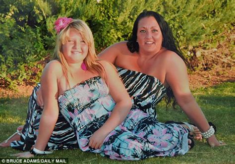 the 13st girl whose weight loss treatment cost you £12 000 daily mail online