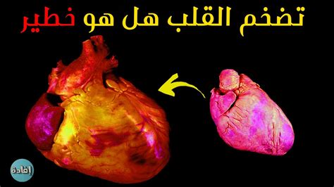 تضخم القلب هل هو خطير