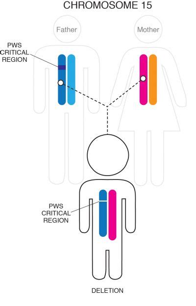 About Prader Willi Syndrome