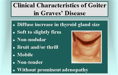 Graves Disease Goiter In Graves Disease Exophtalmos Localized