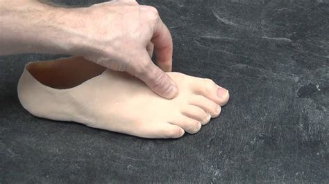 Partial Foot Prosthetic Education Youtube