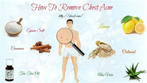 Top 25 Ways On How To Remove Chest Acne Fast