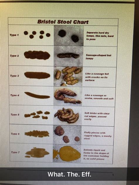 Bristol Stool Chart Poster Stools Item