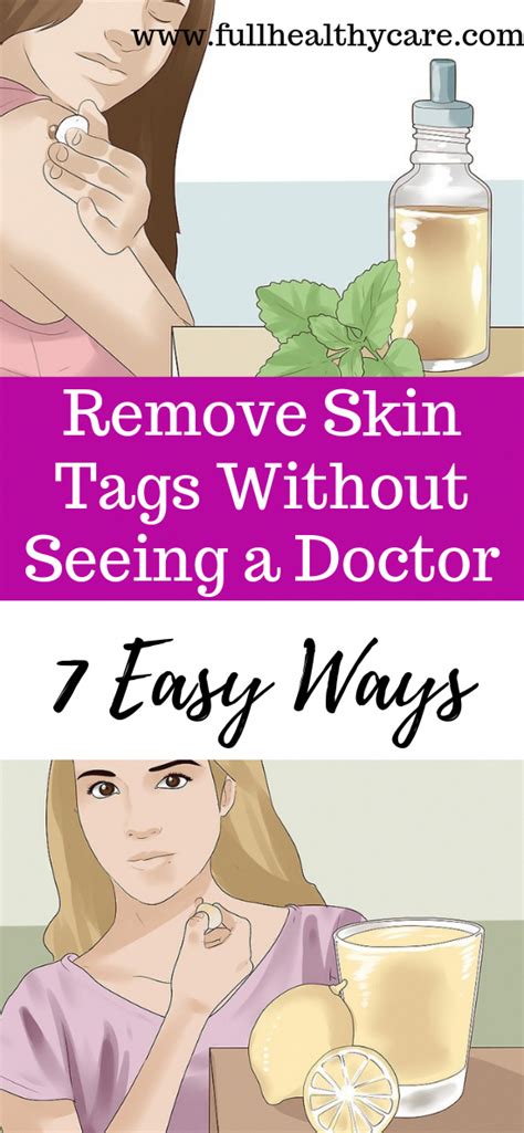remove skin tags without seeing a doctor 7 easy ways skin tag removal skin tag skin