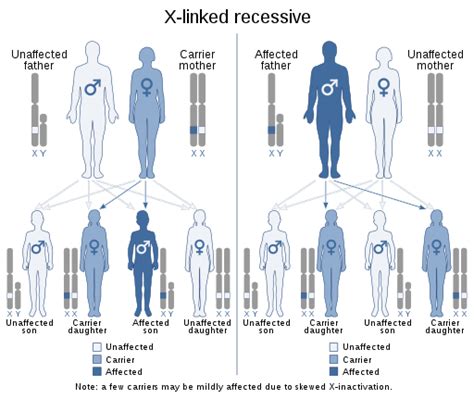 What Is Haemophilia Write Its Sex Linked Inheritance Pattern