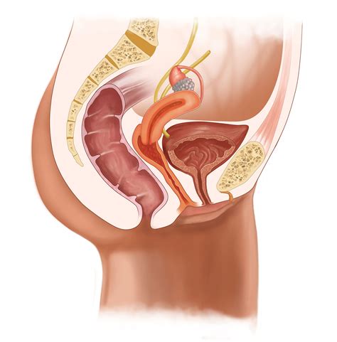 Diagnose Endometriose Die Unterschätzte Krankheit