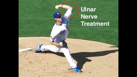 Ulnar Nerve Exercises Youtube