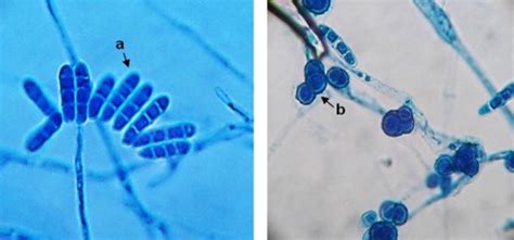 Lactophenol Cotton Blue Mount Showing A Cluster Of Macroconidia With