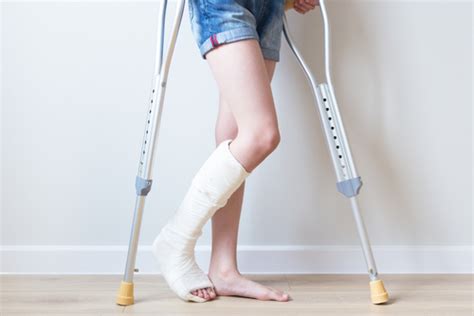 How Much Is My Broken Leg Worth In A Personal Injury Case