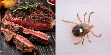 How A Nasty Tick Bite Can Actually Make You Allergic To Red Meat