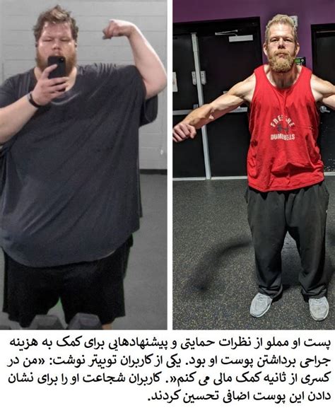 Man Shows Off His Incredible Transformation After Losing More Than 150kgs