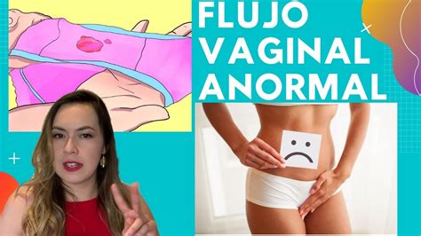 Flujo Vaginal Normal Y Anormal Todo Lo Que Debes Saber Youtube