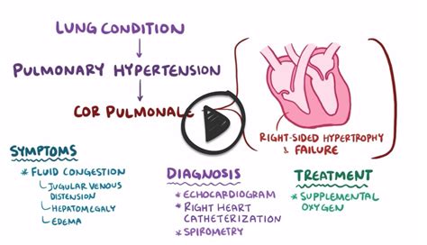 Cor Pulmonalewhat To Know