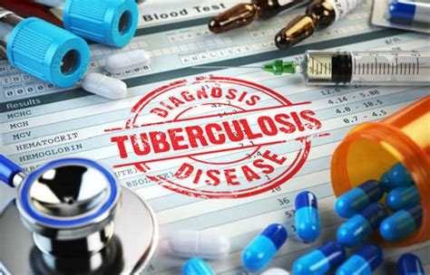 Tuberculosis testing is very mportant. Paper based TB test: Fast paper-based tuberculosis test ...