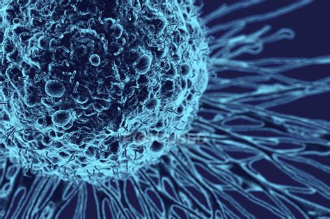 Cancer Cell Anatomy — Condition Pathology Stock Photo 167537182