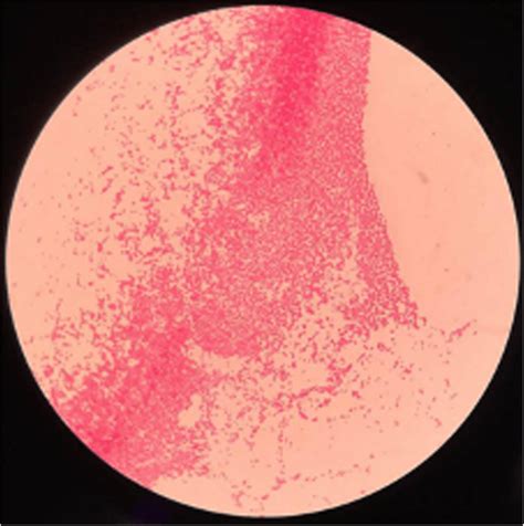 Gram Stained Brucella Colonies Of Cerebrospinal Fluid Culture Under An