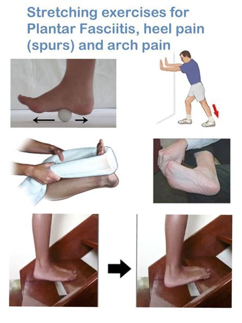 Pin Auf Plantar Fasciitis Remedy