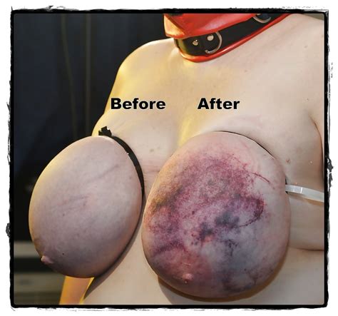 Bbw Extreme Tit Torture 8 Pics Xhamster