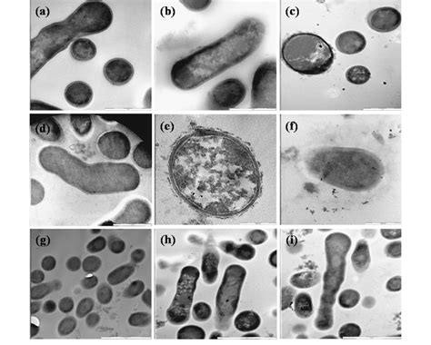 Transmission Electron Micrographs Of Bifidobacterium Bifidum Lmg 11041
