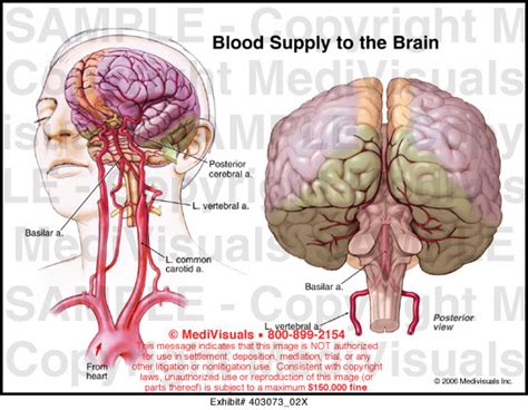 Blood Supply To The Brain Medical Illustration Medivisuals