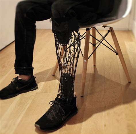 3d Printed Exo Prosthetic Leg Becomes A Customizable Body Part