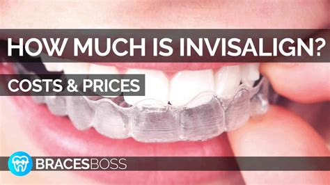 How Much Is Invisalign Cost And Prices Full Pro Guide 2022 Bracesboss