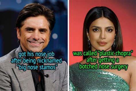 15 Celebrities Whove Gotten Candid About Getting Nose Jobs And Why