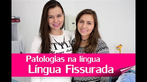 Patologias Na Língua Língua Fissurada Youtube