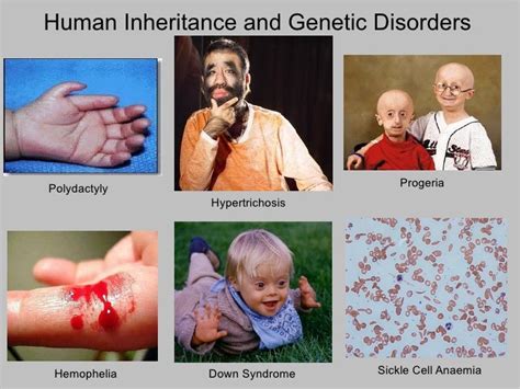 Human Inheritance And Genetic Disorders
