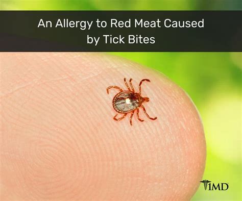 Meat Allergies May Be Spreading Thanks To The Lone Star Tick 1md