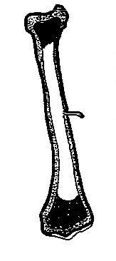 Many kids end up with broken bones from jumping on them. Anatomy and Physiology of Animals/The Skeleton - Wikibooks ...