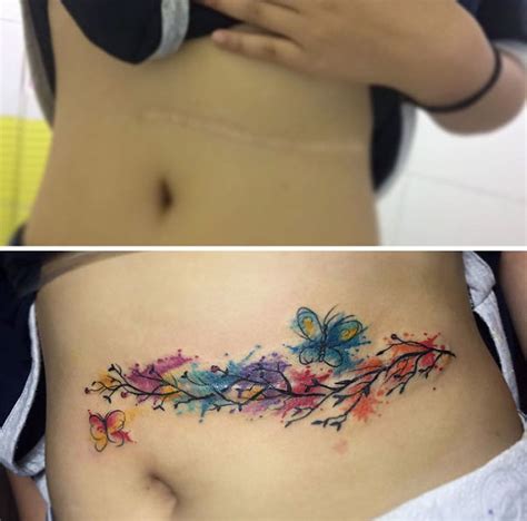 Incredible Scar Tattoo Cover Ups Transforming Imperfections Into Art Today H Com