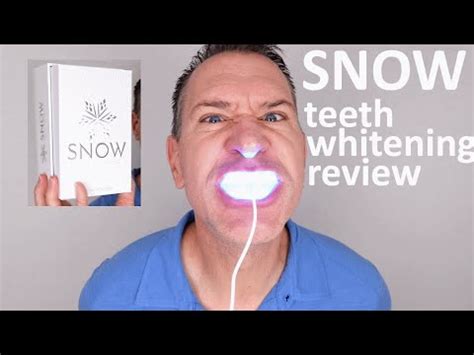 SNOW Teeth Whitening Review Unboxing Does Snow Really Work YouTube