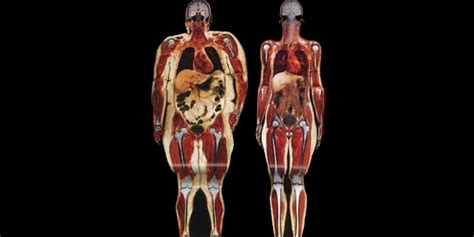 A Visual Comparison Of How Fat Affects The Human Anatomy